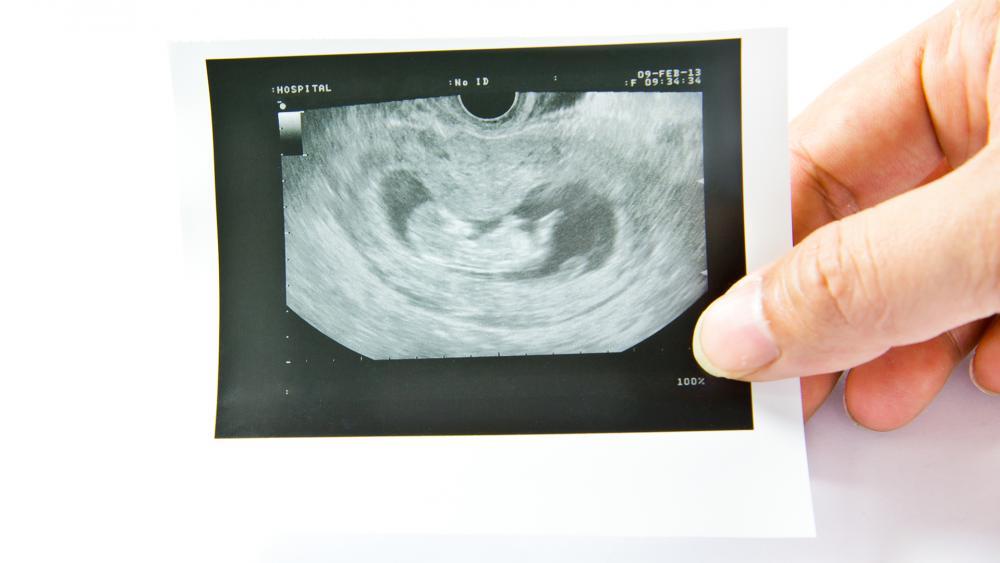 abortionstories hdv 0 - Padre argentino lucha para que no aborten a su hijo